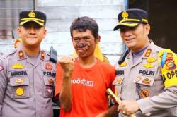 Peduli Warga, Kapolres Bengkalis Bantu Penderita Penyakit Kanker Kulit Berobat