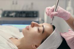 Inilah 4 Manfaat Treatment Microneedling yang Minim Risiko, Salah Satunya Bikin Awet Muda