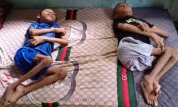 Menteri Sosial akan Temui Dua Anak Penyandang Disabilitas dari Manggarai Timur