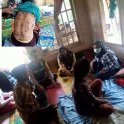 Disiksa Majikan, TKW asal Sobang Pandeglang Mengalami Kebutaan dan Lumpuh