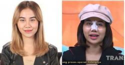 Ketagihan! Usai Oplas Hidung, Mayang Mengaku Akan Lakukan Oplas di Bagian Ini