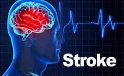 Awas! Stroke Mendadak Kaum Pria : Penyebab, Gejala dan Cara Mengatasi