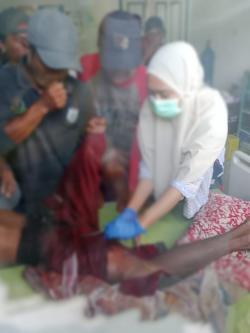 1 Warga Jadi Korban Terkaman Buaya, Kades Lamba Lamba Mateng Imbau Selalu Waspada