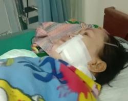 Begini Kondisi Terbaru Istri yang Dianiaya Suami di Lebak, Keluarga Berharap Ada Mukjizat