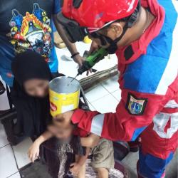 Mau Senyum Tetapi Kasihan, Seorang Bocah Iseng Kepalanya Tersangkut Kaleng Biskuit di Jakpus