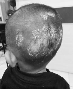 Miris, Bocah 2 Tahun di Palopo Dianiaya dengan Sadis oleh Ibu Tiri
