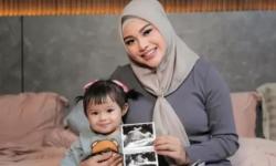 Hamil Anak Kedua, Aurel Hermansyah Banjir Ucapan Selamat dan Doa dari Selebritis