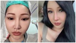 Biar Mirip Jennie Blackpink, Wajah Lucinta Luna Kembali Dipermak