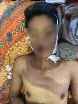 Di Batu Bara Seorang Pemuda Tewas Tersengat Arus Listrik Saat Memanen Sawit