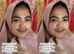 Viral! Pengantin Wanita Berkumis Tebal Dirubah MUA Bikin Pangling