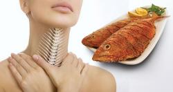 5 Tips Mengatasi Duri Ikan Tersangkut di Tenggorokan agar Tak Infeksi