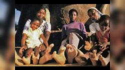 Miliki Sejarah Inces, Inilah Kisah Unik Suku Vadoma di Zimbabwe yang Punya Kaki Mirip Burung Unta
