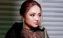 Marshanda Disorot Netizen karena Wajah Gradakan atau tidak Mulus