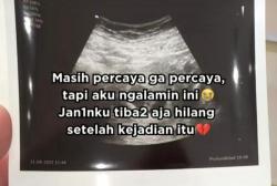 Wanita Hamil Ini Janinnya Hilang Gegara Boncengi Nenek-Nenek Tak Dikenal,Siapakah Dia?