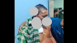 Kades Dibacok Warganya  saat Tidur Hingga Hidung Robek, Inilah Kronologinya