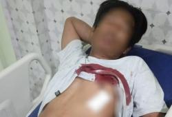Pelaku Penusukan Pemuda Betek Jombang Malam Takbiran Masih Buron, Korban Luka Berat