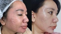 Treatment Juvenation 7D by DL Signature, Perawatan untuk Wajah Awet Muda