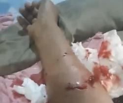 Hendak Wudu Pria Paruh Baya di Desa Tanjung Terantang Kobar Diterkam Buaya
