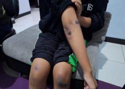 Siswi SMP Jadi Korban Pemerkosaan Bergilir di Probolinggo, Korban Trauma Sempat Mau Bunuh Diri