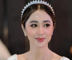 Viral! Artis Dewi Perssik Bantah Tudingan Mandul, Bagikan Foto Hasil USG