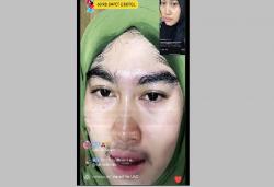 Mengerikan Wajah Wanita Ini Muncul Bulu Lebat Usai Pakai Skincare, Sumpah Malah Seram