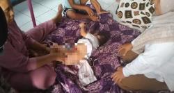 Abizar, Anak 3 Tahun Tak Miliki Lubang Anus, Orang Tua Tak Punya Biaya Operasi