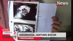 Bayi Penderita Jantung Bocor di Tanggamus Meninggal Dunia