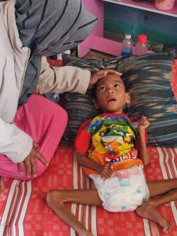 Miris! Tak Tersentuh Program Makan Bergizi Gratis, Anak Gizi Buruk di Bogor Meninggal Dunia