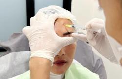 Atasi Kelopak Mata Kendor Tanpa Botox, Estine Clinic Tawarkan Solusi Probio Booster