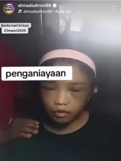 Viral! ART Asal Banyumas Diduga Dianiaya di Jakarta, Pulang dengan Luka Parah