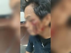 Kronologis Pedagang Es Krim Diduga Dikeroyok Oknum Satpol PP di Alun-Alun Lumajang