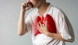 Waspadai Tuberkulosis Tanpa Batuk, Bisa Serang Kelenjar hingga Otak