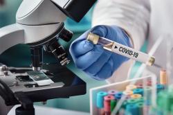 Waspada! Kemenkes Deteksi 72 Kasus Covid-19 Varian Baru di RI