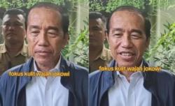 Presiden Ke 7 Joko Widodo Diduga Terkena Sindrom Stevens Johnson: Penyakit Kulit Langka 