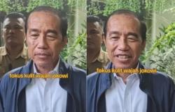 Jokowi Absen karena Sakit Kulit, Muncul Spekulasi Terkait Sindrom Stevens Johnson