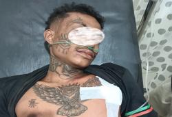 Pria Bertato di Lurasik Bersimbah Darah Akibat Senjata Tajam, 3 Orang Diduga Pelaku