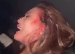 Dibakar Api Cemburu, Wanita Cantik Berlumuran Darah Dipukul Pakai Senjata Api di Klub Malam