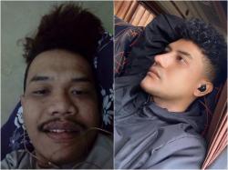 Viral Sakit Hati Gak Diterima Kerja karena Tampangnya Pas-pasan, Pria Ini 10 Kali Operasi Wajah