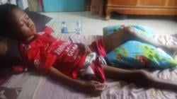 Derita Meningitis TB, Noval Bocah Asal Limbangan Garut Butuh Uluran Tangan Dermawan