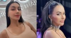 Usai Operasi Rhinoplasty Ratusan Juta Rupiah, Artis Denada Makin Cantik dan Seksi