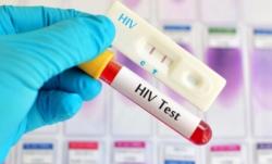Terbukti Reaktif  HIV dan Sifilis, Pemeriksaan Pesta Gay di Puncak Bogor