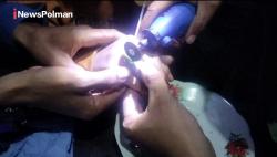 Aksi Sigap Damkar Polman: Selamatkan Anak dari Cincin yang Terjebak di Jari