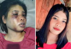 Intan, ART Asal Sumba Selain Dipukul juga Tak Digaji hingga Dipaksa Makan Kotoran Anjing