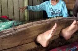 Membahayakan Keselamatan Orang, Dua ODGJ di Kobar Dipasung Pihak Keluarga di Rumah
