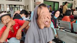 Kisah Pilu Kholipah, Perempuan Asal Pemalang yang Menderita Penyakit Aneh di Wajah
