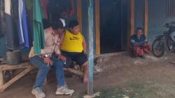 Tak Bisa Sekolah dan Bermain, Bocah di Tuban Derita Obesitas Sejak Bayi
