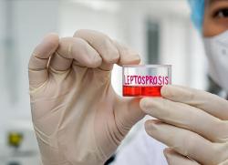 22 Kasus Leptospirosis Tercatat di Lumajang, Masyarakat Diimbau Waspada Saat Musim Peralihan