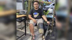 Tragis! Kurir J&T di Medan Dipecat Usai Kecelakaan Fatal, Kaki Diamputasi hingga Ijazah Ditahan