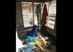 Miris! Bocah 8 Tahun di Lebak Alami Stunting Parah, Tubuh Tinggal Kulit Membalut Tulang