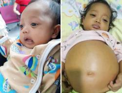 Anak Naura Butuh Bantuan, Balita di Papua Barat Daya Ini Berjuang Lawan Penyakit Langka